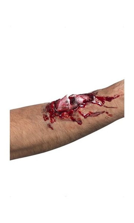 Broken Bone Scar